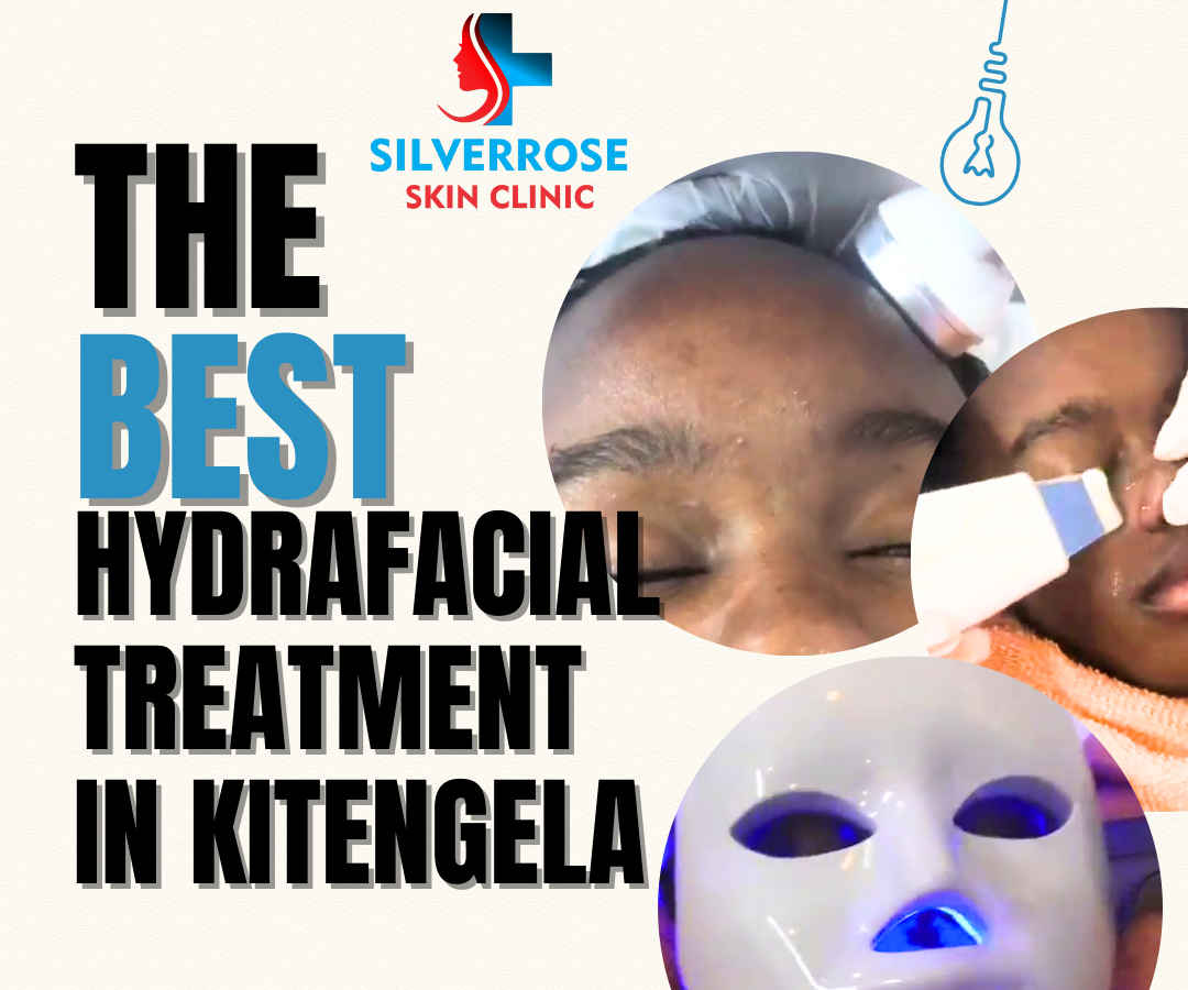 The Best Hydrafacial Treatment in Kitengela