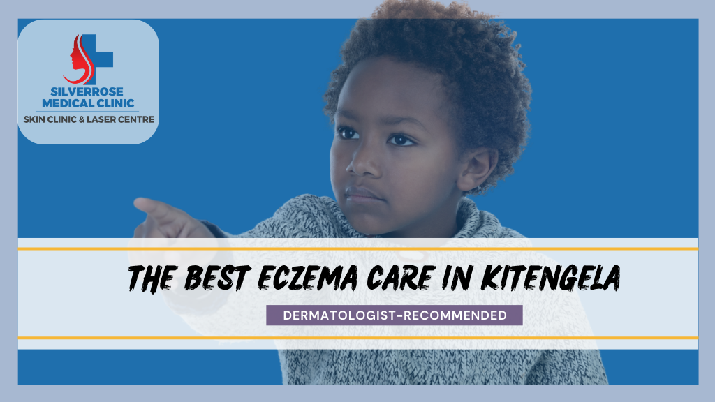 the Best Eczema Care in Kitengela
