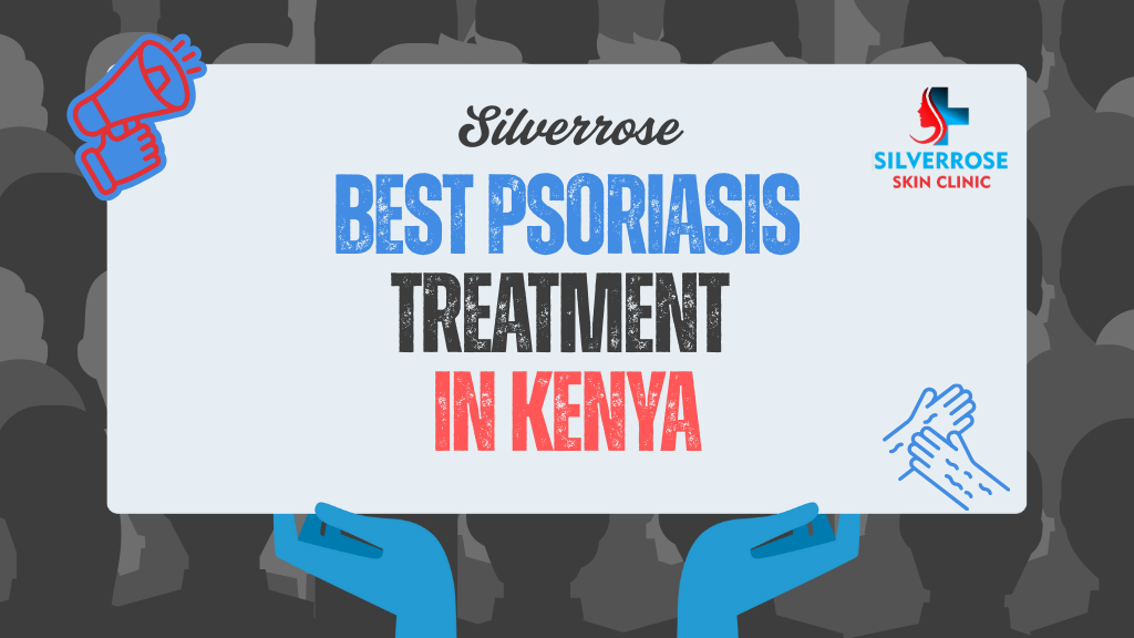 Best Psoriasis Treatment in Kenya