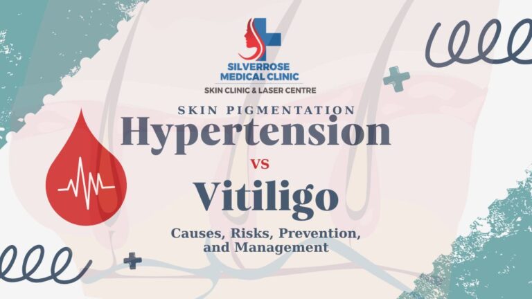Hypertension Vs Vitiligo