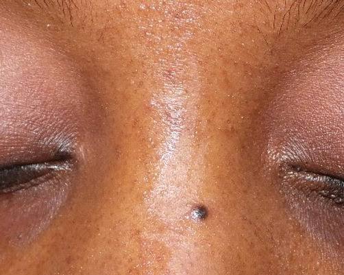 Moles