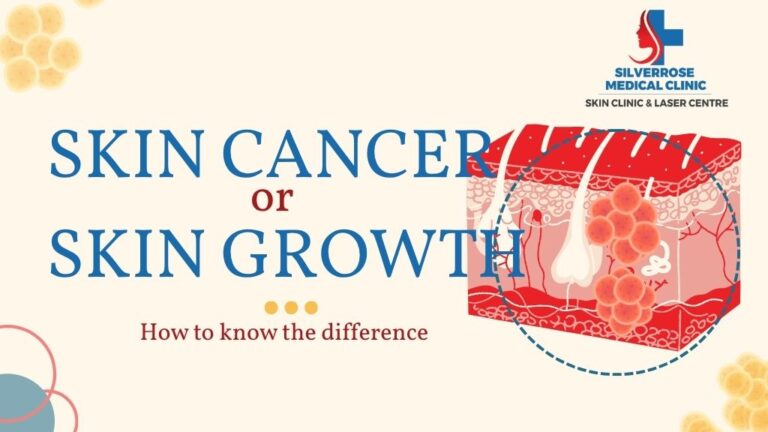 Skin Cancer or Skin Growth