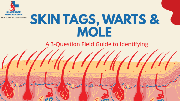 skin tags, warts & mole