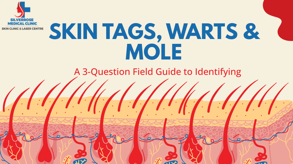 skin tags, warts & mole